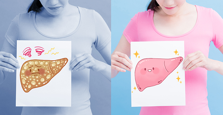 درمان کبد چرب به کمک طب سنتی کبد درمان کبد چرب به کمک طب سنتی کبد